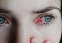 મોરબીમાં હવે મ્યુકરમાઇકોસિસના ઈલાજ માટેના ઇન્જેક્શનોની હાલાકી